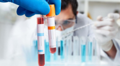 Influenza service image 1